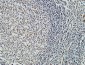 Bcl-2 Monoclonal Antibody(6B5)